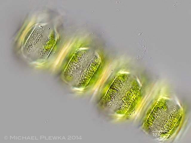 Limnic and other from Germany Desmidium grevillei